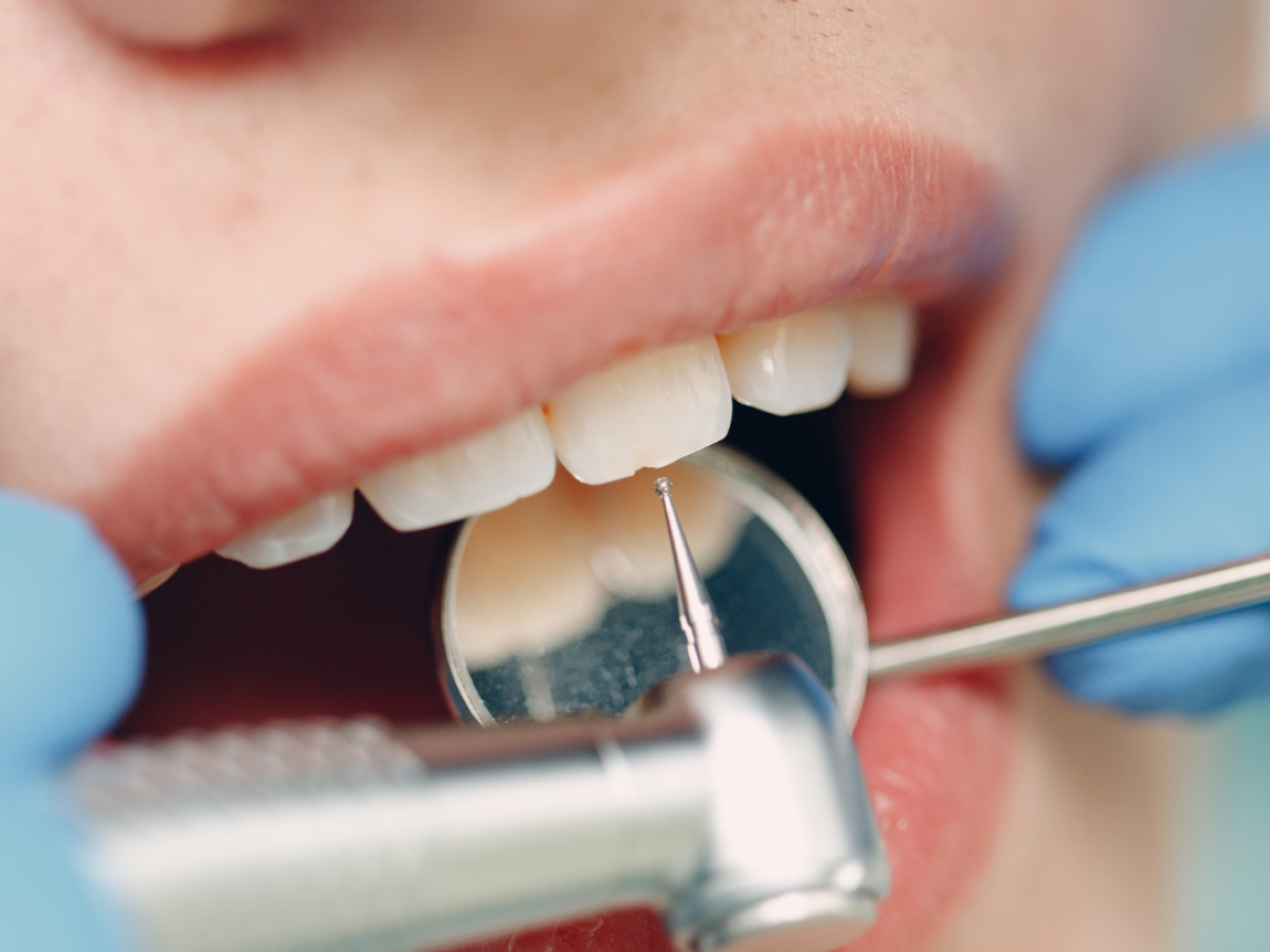 El impacto positivo de la ortodoncia en la salud mental de las personas: Cómo este tratamiento cambia la vida de los pacientes 